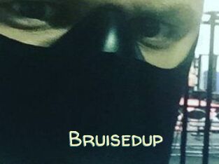 Bruisedup