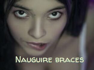 Nauguire_braces